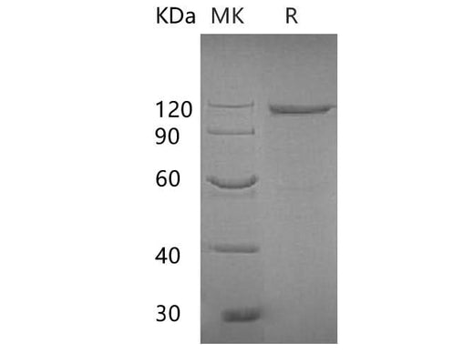 Recombinant E.coli Beta-galactosidase Protein - ABMIUM