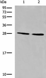 Anti-Human/Mouse CYB5D1 Antibody - ABMIUM