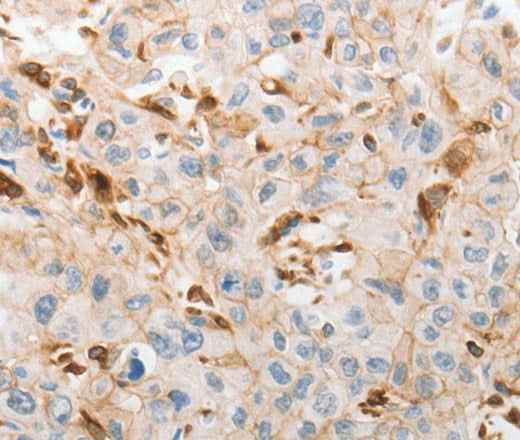 Anti-Human SLC15A2 Antibody