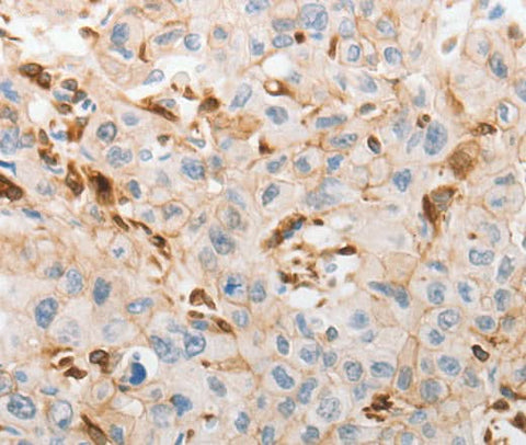 Anti-Human SLC15A2 Antibody - ABMIUM
