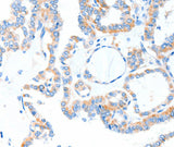 Anti-Human/Mouse TLR2 Antibody - ABMIUM