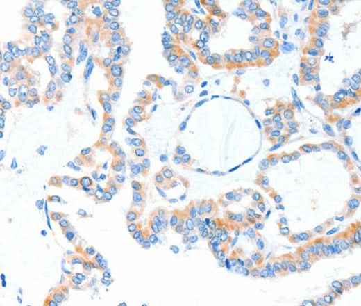 Anti-Human/Mouse TLR2 Antibody