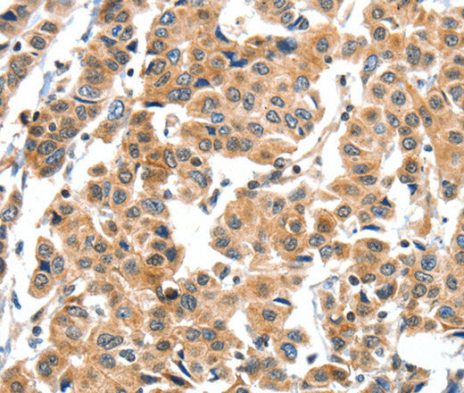 Anti-Human XBP1 Antibody - ABMIUM