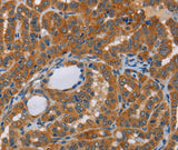 Anti-Human/Mouse/Rat KRT13 Antibody - ABMIUM