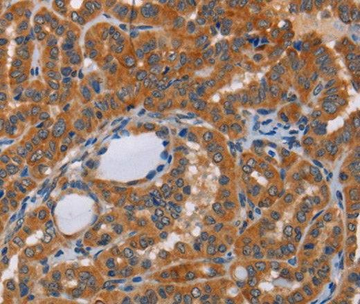 Anti-Human/Mouse/Rat KRT13 Antibody - ABMIUM