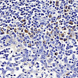 Immunohistochemistry analysis of paraffin-embedded human tonsil using SIRT7 Polyclonal Antibody at dilution of 1:200.