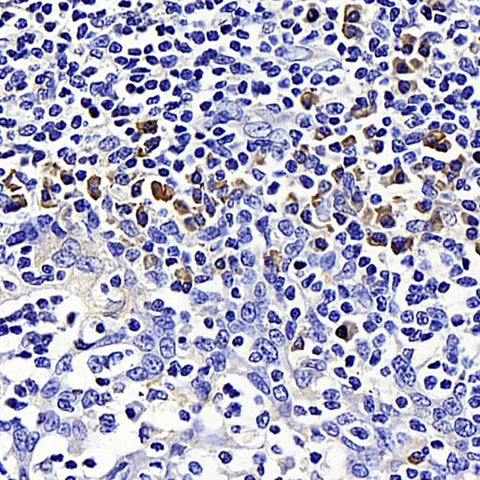 Immunohistochemistry analysis of paraffin-embedded human tonsil using SIRT7 Polyclonal Antibody at dilution of 1:200.