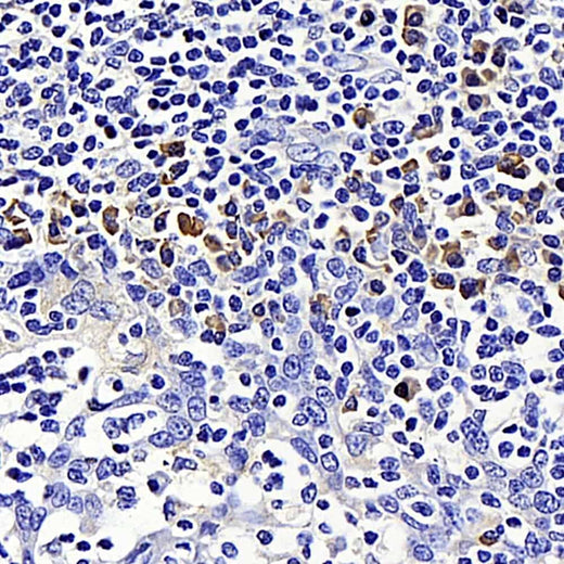 Immunohistochemistry analysis of paraffin-embedded human tonsil using SIRT7 Polyclonal Antibody at dilution of 1:200.