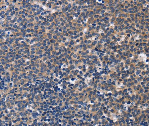 Anti-Human CCR6 Antibody - ABMIUM