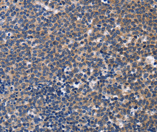 Anti-Human CCR6 Antibody - ABMIUM