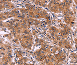 Anti-Human/Mouse/Rat MMP14 Antibody - ABMIUM
