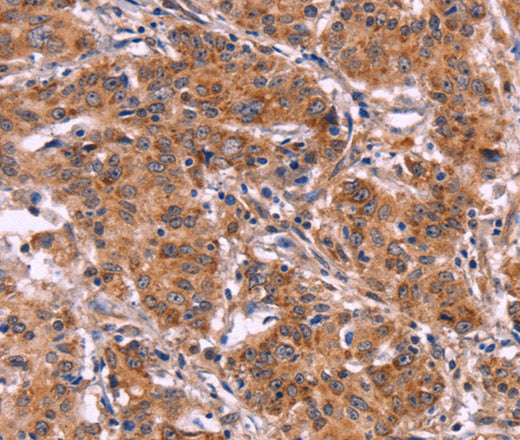Anti-Human/Mouse/Rat MMP14 Antibody - ABMIUM