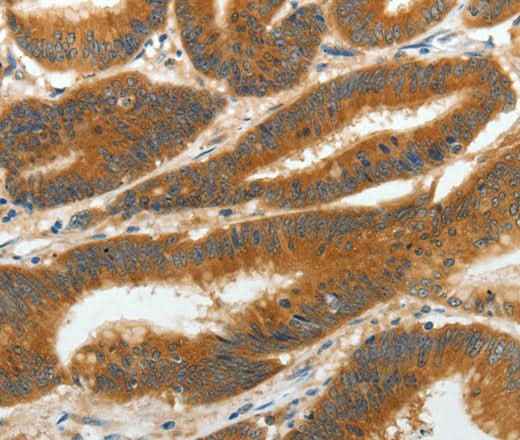 Anti-Human/Mouse/Rat RGS2 Antibody