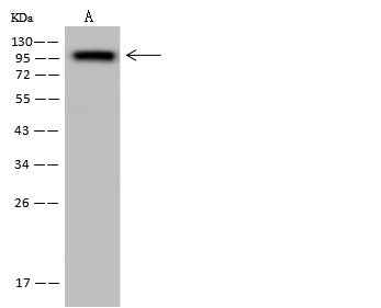 Anti-Human MME Antibody [A1037] - ABMIUM