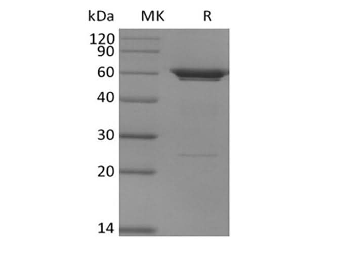 Recombinant Human PFKFB3 (N-6His) - ABMIUM