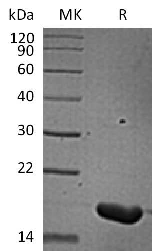 Recombinant Human IL-36 Beta/IL-1F8(157AA) - ABMIUM