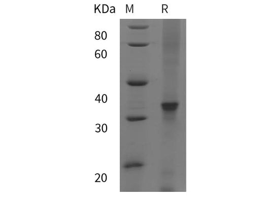 SDS-PAGE analysis of Human PPARGC1B proteins, 2 μg/lane of Recombinant Human PPARGC1B proteins was resolved with SDS-PAGE under reducing conditions, showing bands at 32 kDa.
