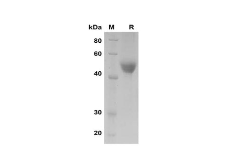 SDS-PAGE analysis of Human AGER proteins, 2 μg/lane of Recombinant Human AGER proteins was resolved with SDS-PAGE under reducing conditions, showing bands at 45-50 kDa.