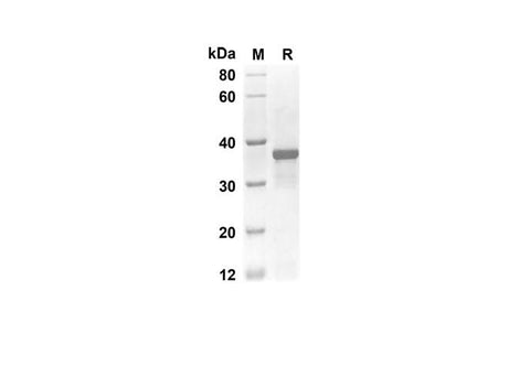 SDS-PAGE analysis of Rat EGF proteins, 2 μg/lane of Recombinant Rat EGF proteins was resolved with an SDS-PAGE under reducing conditions, showing bands at 32 kDa.