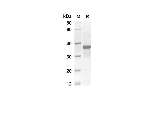 SDS-PAGE analysis of Rat EGF proteins, 2 μg/lane of Recombinant Rat EGF proteins was resolved with an SDS-PAGE under reducing conditions, showing bands at 32 kDa.