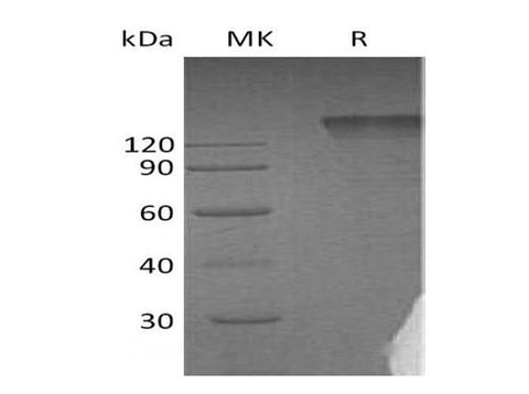 Recombinant Human Semaphorin 4D/SEMA4D Protein (Fc Tag) - ABMIUM