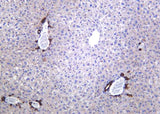 Anti-Human/Mouse/Rat LDLR Antibody [B1169]