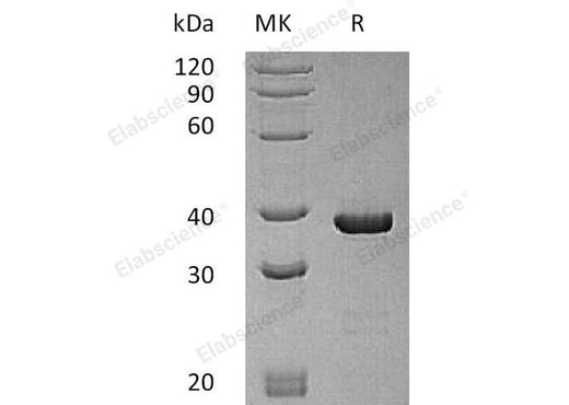 > 95 % as determined by reducing SDS-PAGE.