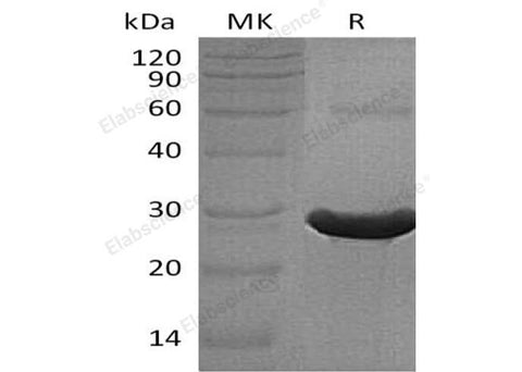 Recombinant Human TXLNA Protein (His Tag) - ABMIUM