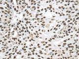 Anti-Human/Mouse/Rat DDX39B Antibody - ABMIUM