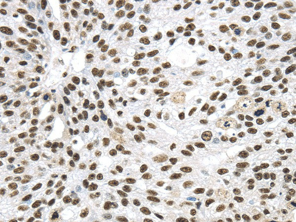 Anti-Human/Mouse/Rat DDX39B Antibody - ABMIUM