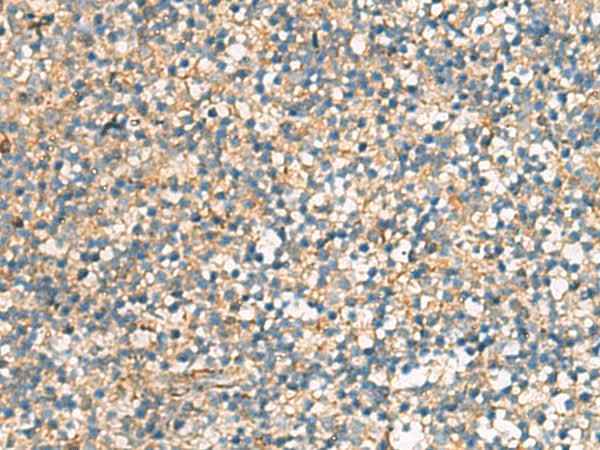 Anti-Human/Mouse/Rat KIF2C Antibody