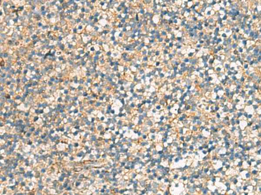 Anti-Human/Mouse/Rat KIF2C Antibody