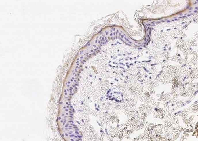 Anti-Human CST6 Antibody [A870] - ABMIUM