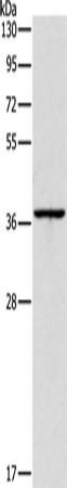 Anti-Human APOL2 Antibody - ABMIUM