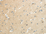 Anti-Human/Mouse SLC7A11 Antibody - ABMIUM