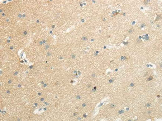 Anti-Human/Mouse SLC7A11 Antibody