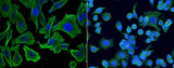 Anti-Human CCL7 Antibody [A1069] - ABMIUM