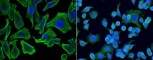 Anti-Human CCL7 Antibody [A1069] - ABMIUM