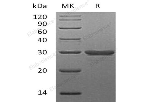 Recombinant Human Galectin-3/LGALS3 Protein - ABMIUM