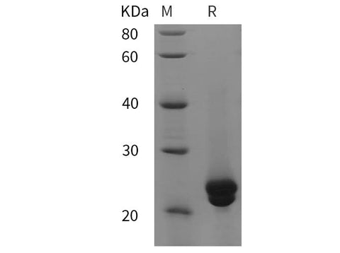 SDS-PAGE analysis of Mouse NFATc1 proteins, 2 μg/lane of Recombinant Mouse NFATc1 proteins was resolved with SDS-PAGE under reducing conditions, showing bands at 23 kDa.