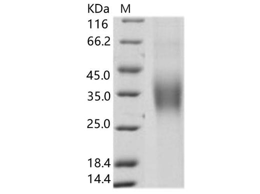 Recombinant HCV Envelope Glycoprotein E1 / HCV-E1 (subtype 1b, strain HC-J4) Protein (His Tag) - ABMIUM