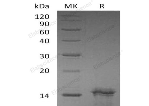 Recombinant Human Interleukin-31/IL-31 Protein - ABMIUM
