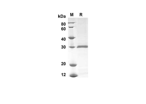 SDS-PAGE analysis of Mouse Ly6g proteins , 2 μg/lane of Recombinant Mouse Ly6g proteins was resolved with SDS-PAGE under reducing conditions , showing bands at 30 kDa.