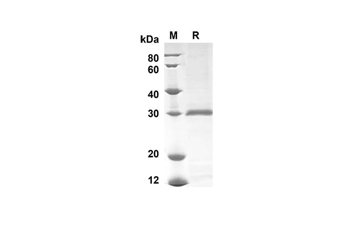 SDS-PAGE analysis of Mouse Ly6g proteins , 2 μg/lane of Recombinant Mouse Ly6g proteins was resolved with SDS-PAGE under reducing conditions , showing bands at 30 kDa.