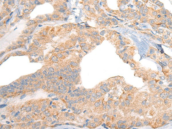 Anti-Human/Mouse/Rat RGS19 Antibody - ABMIUM