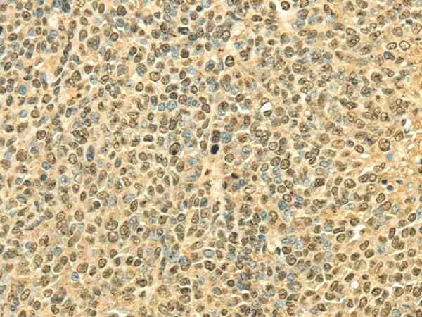 Anti-Human RPA2 Antibody