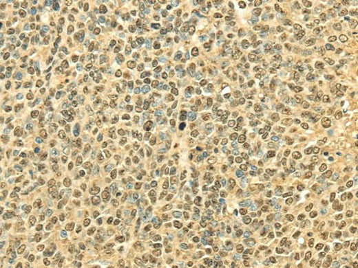 Anti-Human RPA2 Antibody - ABMIUM