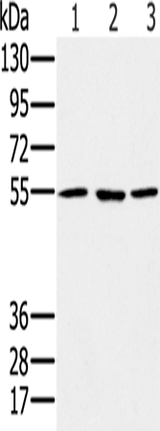 Anti-Human/Mouse/Rat PSMC1 Antibody - ABMIUM