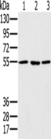Anti-Human/Mouse/Rat PSMC1 Antibody - ABMIUM