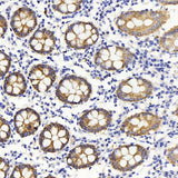 Immunohistochemistry analysis of paraffin-embedded human colon using Claudin 5 Polyclonal Antibody at dilution of 1:400.